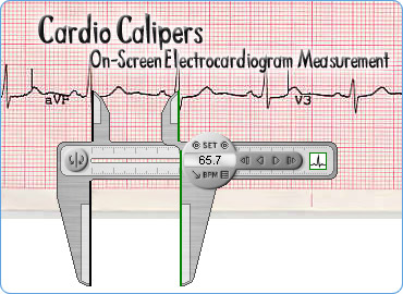 Calipers, application, Cardio, measurement, EKG, screen, protractor, Tools, extractor, ECG, heart, BPM, mv, mm, msec, rate, medi